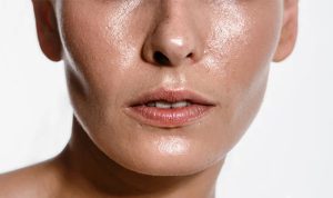 کرم ضد لک برای لک های قهوه ای تیره