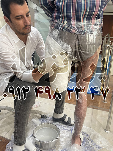 پروتزساز کیست و چه مهارت هایی دارد؟